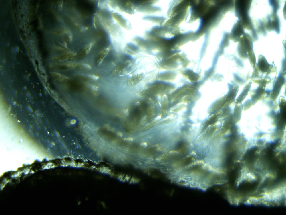 Pond algae up close under the microscope